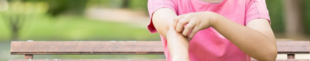 Person mit Neurodermitis kratzt sich am Arm